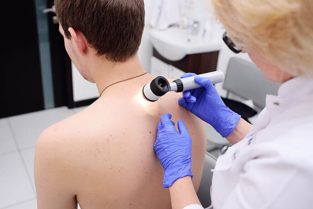 skin-cancer-screening
